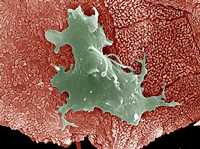 En el centro de la imagen se observa un Trichomonas vaginalis a través de un microscopio electrónico