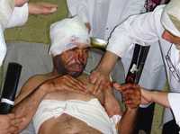 Algunos lesionados fueron trasladados a un hospital de Mahmoudiya, Irak