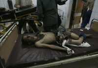 Un iraquí que resultó herido en el estallido de un coche bomba espera atención médica en un hospital de Bagdad