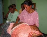 Capacitación de comadronas que forma parte del Programa de Reducción de la Mortalidad Materna. El entrenamiento se ofrece en el hospital de Sayaxche, en Petén, Guatemala