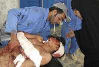 Un civil murió y dos resultaron heridos en un ataque con mortero en la ciudad de Baquba, al noreste de Bagdad. Uno de los lesionados, en la imagen, es atendido en un hospital; ayer se cumplieron cinco años de la caída de la capital iraquí ante la ofensiva estadunidense