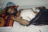 Uno de los afganos heridos por la aviación de las tropas ocupantes yace en un hospital de Asadabab