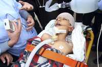 Un menor palestino herido en los bombardeos israelíes recibe atención médica en Rafah