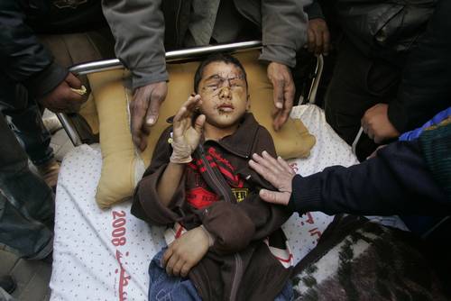 Un menor palestino que perdió ambos ojos en los bombardeos israelíes sobre Gaza, es trasladado a un hospital de Arabia Saudita
